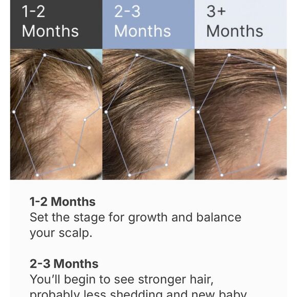 Superpower Thickening Hairpatches - Gold - Picture 7 of 10